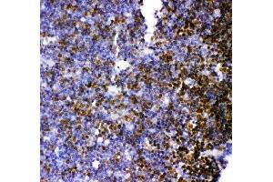Anti-MCAK antibody, (ABIN3043278), IHC(P)IHC(P): Rat Thymus Tissue