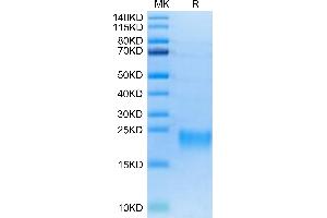 Biotinylated Human BAFFR on Tris-Bis PAGE under reduced conditions.