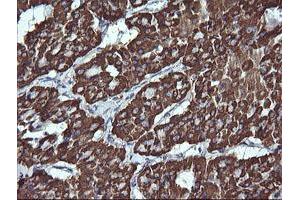 Immunohistochemistry (IHC) image for anti-Acetyl-CoA Acyltransferase 2 (ACAA2) antibody (ABIN1495723)