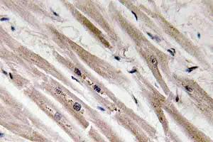 Immunohistochemistry (IHC) analyzes of Caspase12 antibody in paraffin-embedded human heart tissue. (Caspase 12 anticorps)