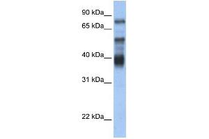 WB Suggested Anti-ZNF395 Antibody Titration:  0. (ZNF395 anticorps  (Middle Region))