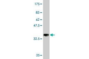 Western Blot detection against Immunogen (37.