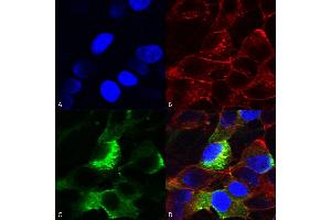 Immunocytochemistry/Immunofluorescence analysis using Mouse Anti-Nav beta3 Monoclonal Antibody, Clone S396-29 (ABIN2485586).