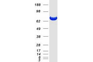 Validation with Western Blot