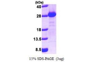 SDS-PAGE (SDS) image for Golgi-Associated PDZ and Coiled-Coil Motif Containing (GOPC) (AA 278-454) protein (His tag) (ABIN666947)