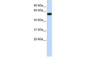 WB Suggested Anti-HIC2 Antibody Titration:  0. (HIC2 anticorps  (Middle Region))