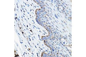 Immunohistochemistry of paraffin-embedded human esophageal using OGDHL Rabbit pAb (ABIN7269135) at dilution of 1:200 (40x lens). (OGDHL anticorps  (AA 1-110))