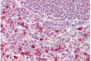 Anti-EIF4B antibody IHC staining of human spleen.