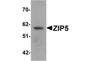 Western blot analysis of ZIP5 in human spleen tissue lysate with ZIP5 antibody at 1 μg/ml. (SLC39A5 anticorps  (Center))