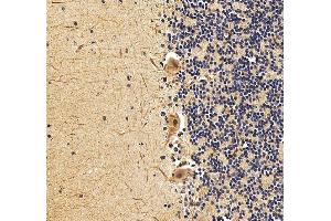 IHC analysis of EXOSC3 using anti-EXOSC3 antibody (ABIN7602216).