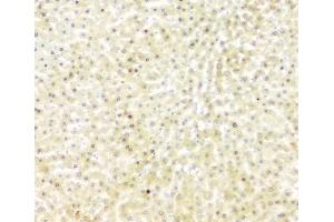 IHC analysis of FH using anti-FH antibody (ABIN7603168).