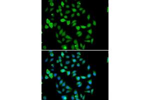 Immunofluorescence analysis of U2OS cells using STAMBP antibody.