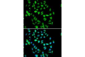 Immunofluorescence analysis of U2OS cells using STAMBP antibody. (STAMBP anticorps  (AA 100-270))