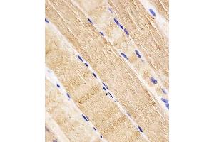 (ABIN652609 and ABIN2842407) staining RAB7 in human skeletal muscle tissue sections by Immunohistochemistry (IHC-P - paraformaldehyde-fixed, paraffin-embedded sections). (RAB7A anticorps  (C-Term))