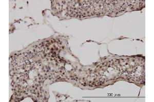Immunoperoxidase of monoclonal antibody to UBB on formalin-fixed paraffin-embedded human testis.