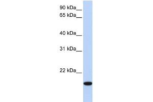 WB Suggested Anti-EVX2 Antibody Titration: 0.