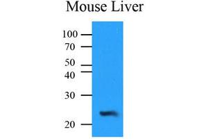 Western Blotting (WB) image for anti-NQO2 (NQO2) antibody (ABIN567621)