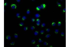 Immunofluorescence staining of A549 cells with ABIN7147175 at 1:50, counter-stained with DAPI.