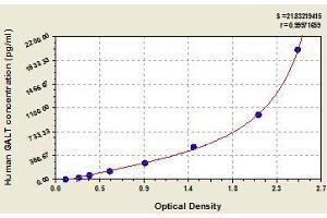 Typical standard curve (GALT Kit ELISA)