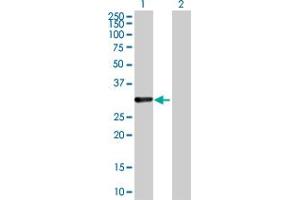 Western Blot analysis of CDCA8 expression in transfected 293T cell line by CDCA8 MaxPab polyclonal antibody. (CDCA8 anticorps  (AA 1-280))