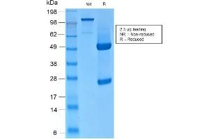 SDS-PAGE Analysis of Purified CK HMW Rabbit Recombinant Monoclonal Antibody (KRTH/2147R).