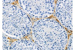 ABIN6256921 and ABIN6275669 at 1/100 staining Mouse testis tissue by IHC-P.