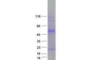 Validation with Western Blot
