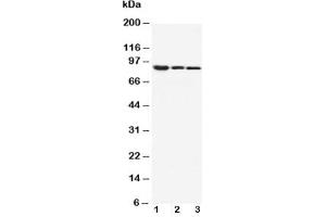 Western blot testing of beta Catenin antibody and Lane 1:  MM453;  2: MCF-7;  3: HeLa cell lysate