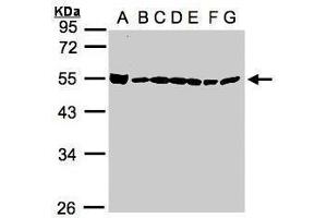 WB Image Sample(30μg whole cell lysate) A: 293T B: A431 , C: H1299 D: HeLa S3 , E: Hep G2 , F: MOLT4 , G: Raji , 10% SDS PAGE antibody diluted at 1:1000 (BAT1 anticorps  (Center))