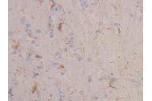 IHC-P analysis of Rat Cerebrum Tissue, with DAB staining.
