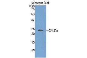 Western Blotting (WB) image for anti-Glutathione Synthetase (GSS) (AA 270-474) antibody (ABIN1859085) (Glutathione Synthetase anticorps  (AA 270-474))