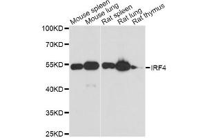 Western blot analysis of extracts of various cell lines, using IRF4 antibody. (IRF4 anticorps)