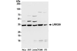 anti-Leucine Rich Repeat Containing 59 (LRRC59) (AA 257-307) antibody