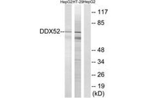 Western blot analysis of extracts from HepG2/HT-29 cells, using DDX52 Antibody.