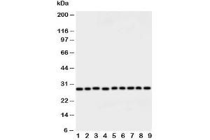 Western blot testing of Peroxiredoxin 3 antibody and rat samples: 1.