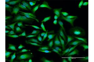 Immunofluorescence of purified MaxPab antibody to IFIT2 on HeLa cell. (IFIT2 anticorps  (AA 1-484))