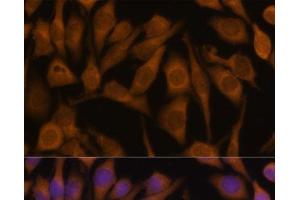 Immunofluorescence analysis of HeLa cells using UBQLN2 Polyclonal Antibody at dilution of 1:100 (40x lens). (Ubiquilin 2 anticorps)