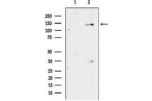anti-Abelson Murine Leukemia Viral Oncogene Homolog 1/2 (ABL1/ABL2) (pTyr393), (pTyr412) antibody
