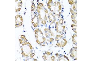 Immunohistochemistry of paraffin-embedded human stomach using ST6G antibody (ABIN6130083, ABIN6148536, ABIN6148538 and ABIN6221427) at dilution of 1:100 (40x lens). (ST6GAL1 anticorps  (AA 27-200))
