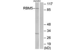 Western blot analysis of extracts from HuvEc cells, using RBM5 Antibody. (RBM5 anticorps  (AA 226-275))