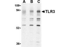 Western blot analysis of TLR3 in K562 cell lysate with this product at (A) 0. (TLR3 anticorps  (N-Term))