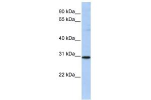 RAB26 antibody used at 1 ug/ml to detect target protein. (RAB26 anticorps  (N-Term))