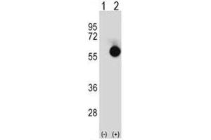 Western blot analysis of CTBP2 antibody and 293 cell lysate either nontransfected (Lane 1) or transiently transfected (2) with the CTBP2 gene. (CTBP2 anticorps  (AA 1-30))