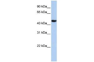 WB Suggested Anti-ZNF286A Antibody Titration:  0. (ZNF286A anticorps  (N-Term))