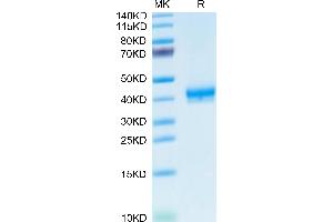 Human CADM3 on Tris-Bis PAGE under reduced condition.