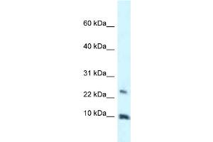 WB Suggested Anti-HMGN3 Antibody Titration: 1. (HMGN3 anticorps  (Middle Region))