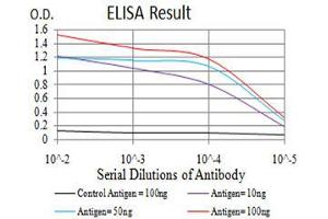 Black line: Control Antigen (100 ng),Purple line: Antigen (10 ng), Blue line: Antigen (50 ng), Red line:Antigen (100 ng)