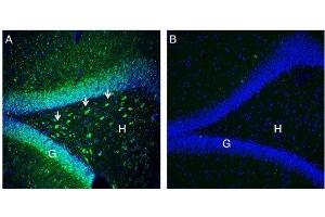 Expression of NrCAM in rat hippocampus.