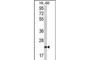Western blot analysis of KLRC2 Antibody (N-term) (ABIN652570 and ABIN2842383) in HL-60 cell line lysates (35 μg/lane). (KLRC2 anticorps  (N-Term))