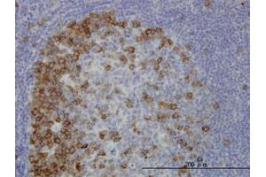 Image no. 1 for anti-Transforming, Acidic Coiled-Coil Containing Protein 3 (TACC3) (AA 1-101) antibody (ABIN6745991) (TACC3 anticorps  (AA 1-101))